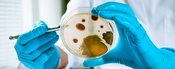 Listeria